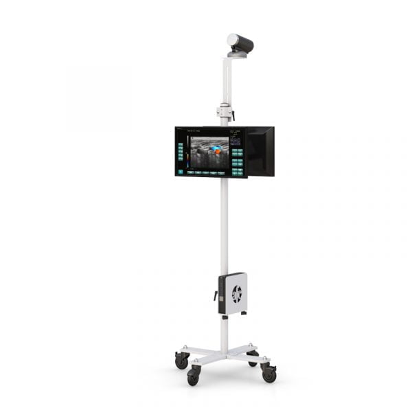 Mobile Scanning Fever Detection Remote Cart